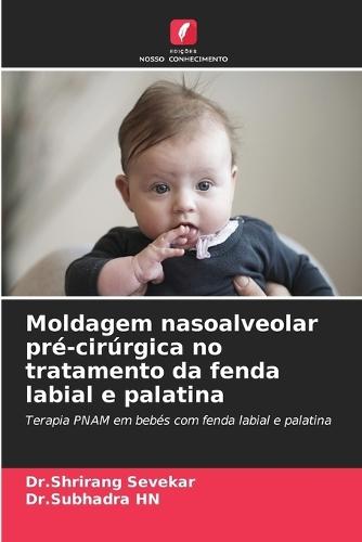 Moldagem nasoalveolar pré-cirúrgica no tratamento da fenda labial e palatina