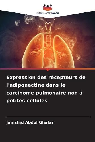 Expression des récepteurs de l'adiponectine dans le carcinome pulmonaire non à petites cellules
