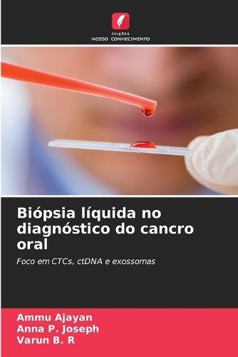 Biópsia líquida no diagnóstico do cancro oral
