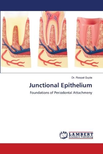 Junctional Epithelium