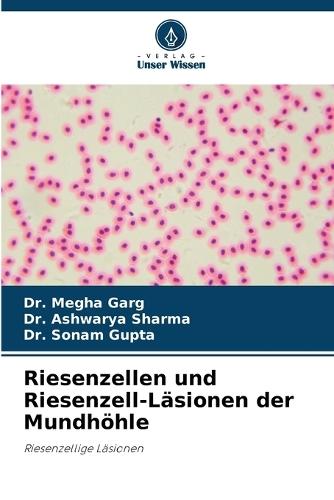 Riesenzellen und Riesenzell-Läsionen der Mundhöhle