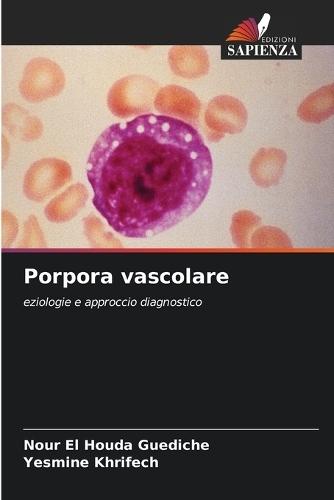 Porpora vascolare