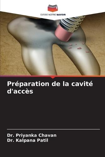 Préparation de la cavité d'accès