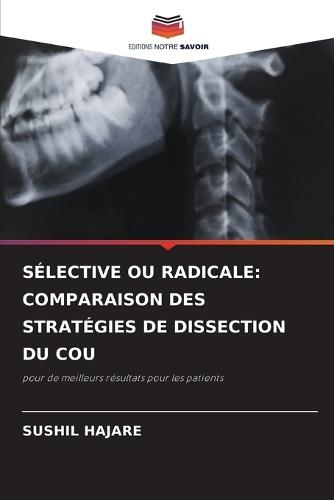 Sélective Ou Radicale: Comparaison Des Stratégies de Dissection Du Cou