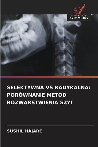 Selektywna Vs Radykalna: Porównanie Metod Rozwarstwienia Szyi