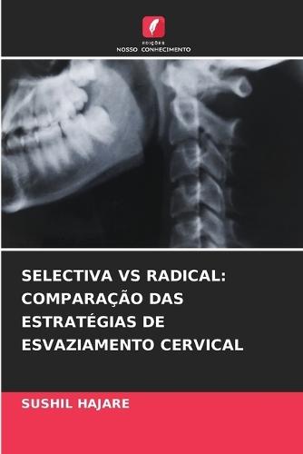 Selectiva Vs Radical: Comparação Das Estratégias de Esvaziamento Cervical