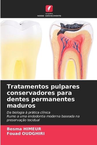 Tratamentos pulpares conservadores para dentes permanentes maduros