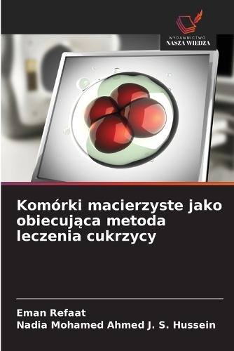 Komórki macierzyste jako obiecująca metoda leczenia cukrzycy