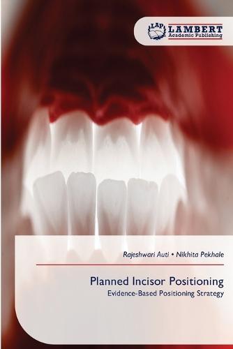Planned Incisor Positioning