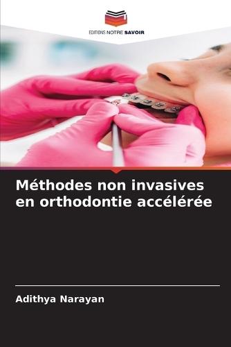 Méthodes non invasives en orthodontie accélérée
