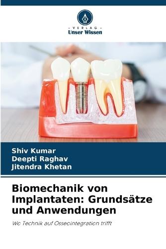 Biomechanik von Implantaten: Grundsätze und Anwendungen