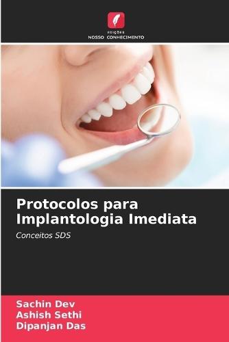 Protocolos para Implantologia Imediata
