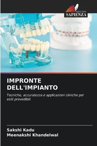 Impronte Dell'impianto