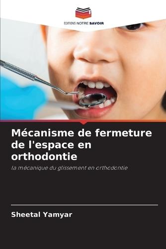 Mécanisme de fermeture de l'espace en orthodontie