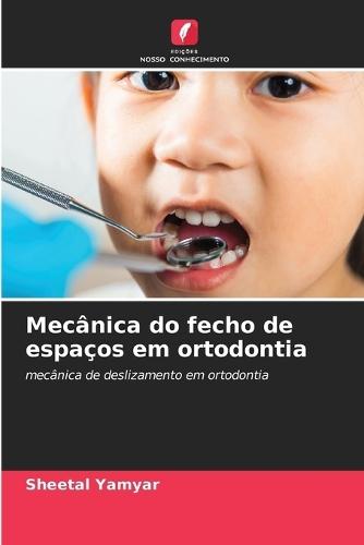 Mecânica do fecho de espaços em ortodontia