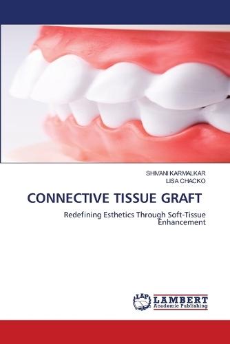 Connective Tissue Graft