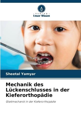 Mechanik des Lückenschlusses in der Kieferorthopädie