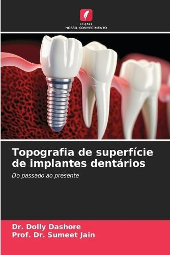 Topografia de superfície de implantes dentários
