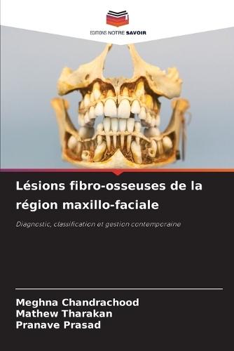 Lésions fibro-osseuses de la région maxillo-faciale