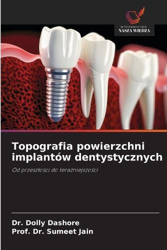 Topografia powierzchni implantów dentystycznych