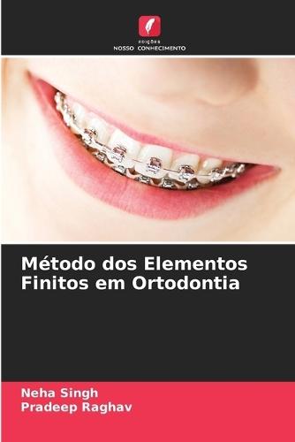 Método dos Elementos Finitos em Ortodontia