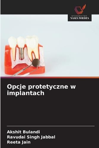 Opcje protetyczne w implantach