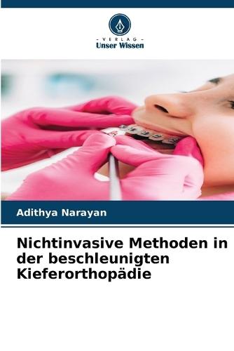 Nichtinvasive Methoden in der beschleunigten Kieferorthopädie