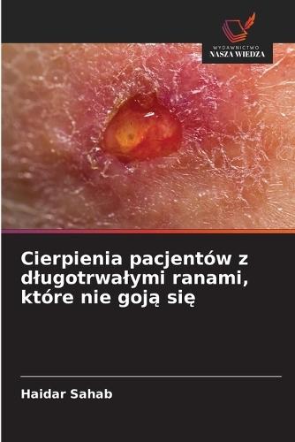 Cierpienia pacjentów z dlugotrwalymi ranami, które nie goją się