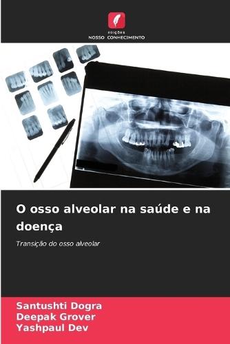 O osso alveolar na saúde e na doença
