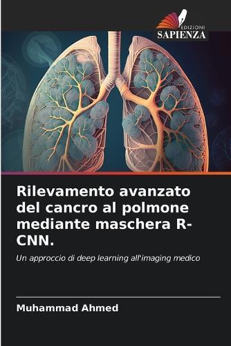 Rilevamento avanzato del cancro al polmone mediante maschera R-CNN.