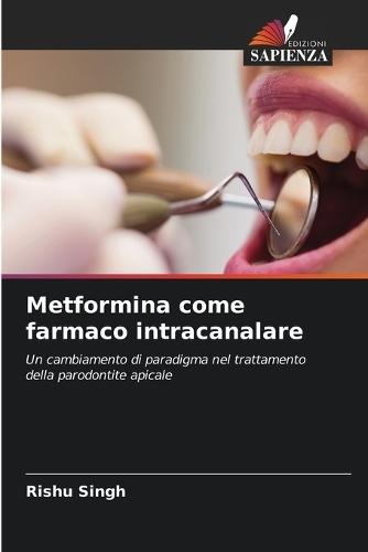 Metformina come farmaco intracanalare