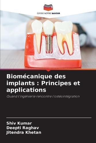 Biomécanique des implants: Principes et applications