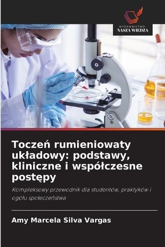 Toczeń rumieniowaty ukladowy: podstawy, kliniczne i wspólczesne postępy