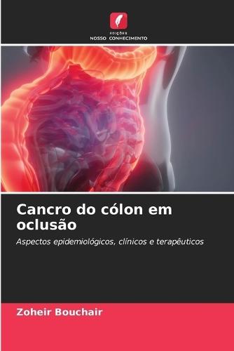 Cancro do cólon em oclusão