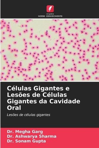 Células Gigantes e Lesões de Células Gigantes da Cavidade Oral