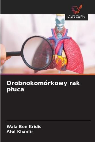 Drobnokomórkowy rak pluca