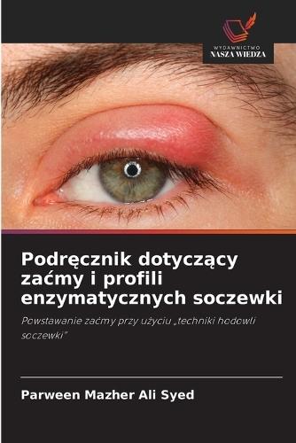Podręcznik dotyczący zacmy i profili enzymatycznych soczewki