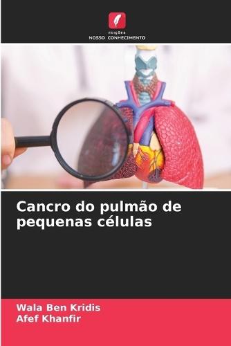 Cancro do pulmão de pequenas células