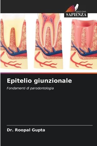 Epitelio giunzionale