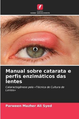 Manual sobre catarata e perfis enzimáticos das lentes