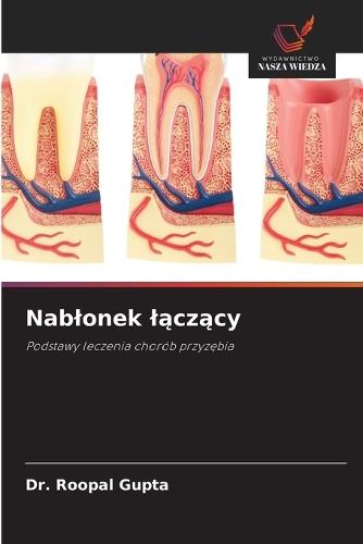 Nablonek lączący