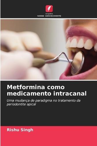 Metformina como medicamento intracanal