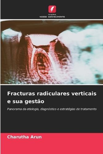 Fracturas radiculares verticais e sua gestão