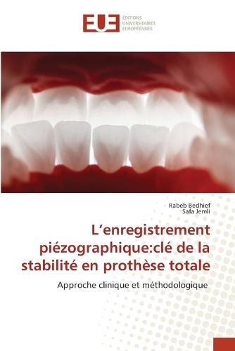 L'enregistrement piézographique: clé de la stabilité en prothèse totale