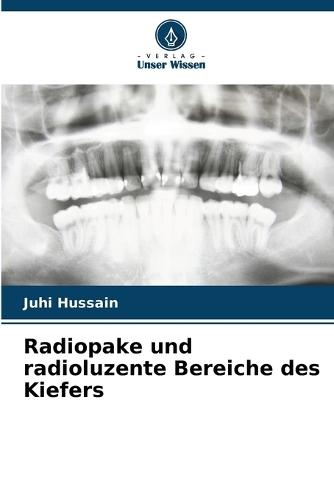 Radiopake und radioluzente Bereiche des Kiefers