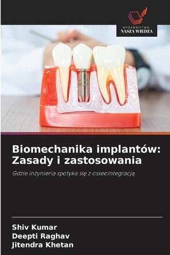 Biomechanika implantów: Zasady i zastosowania