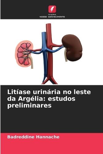 Litíase urinária no leste da Argélia: estudos preliminares