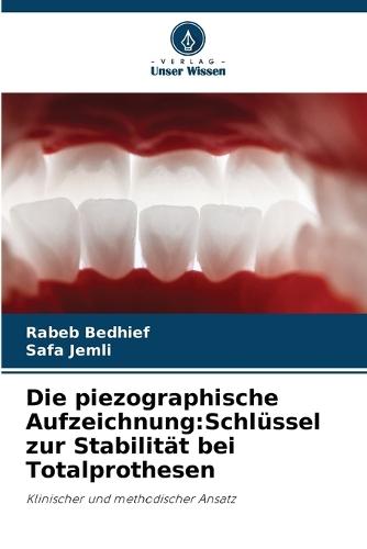 Die piezographische Aufzeichnung: Schlüssel zur Stabilität bei Totalprothesen