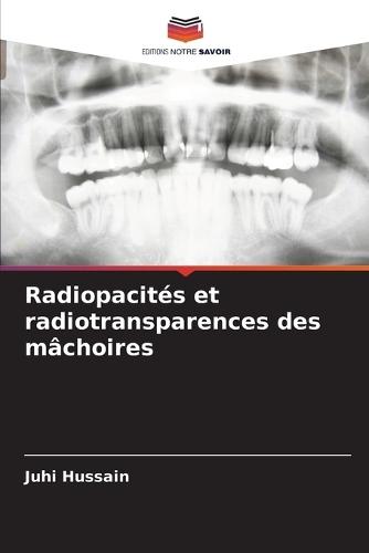 Radiopacités et radiotransparences des mâchoires