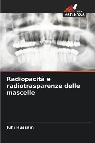 Radiopacità e radiotrasparenze delle mascelle